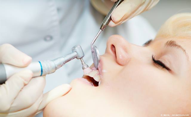 Professionelle Zahnreinigung (PZR) zum Schutz vor Karies, Parodontitis und Mundgeruch